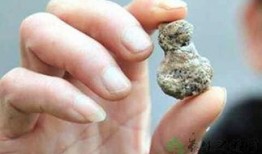 肾结石吃脆瓜,脆瓜助力健康排石